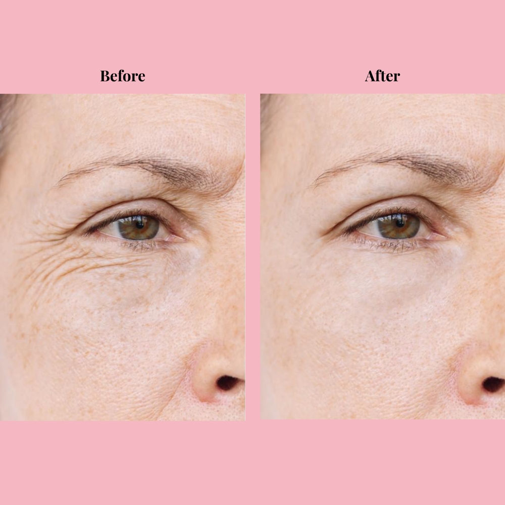 Omera's Calcium Volume Balm