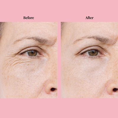 Omera's Calcium Volume Balm