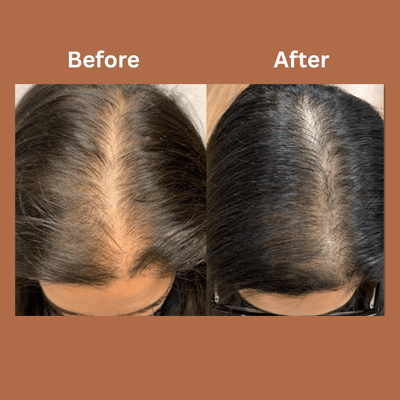 Omera Natural Hair Growth Serum