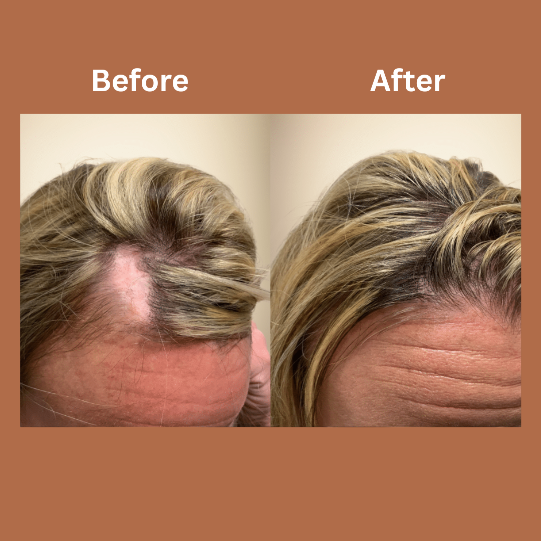 Omera Natural Hair Growth Serum