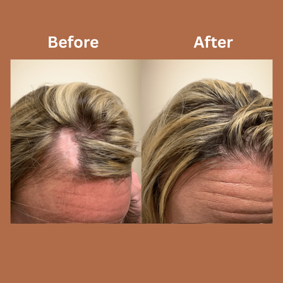 Omera Natural Hair Growth Serum