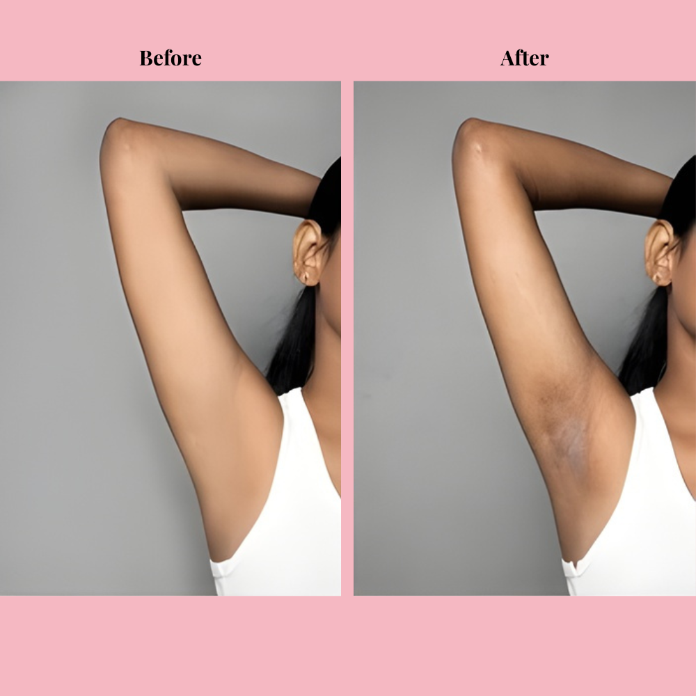 Omera's Cyperus Rotundus Hair Removal Oil