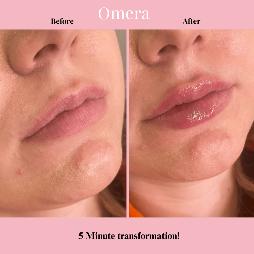 Omera's Tri-Plump VolumeFill® Lip Kit
