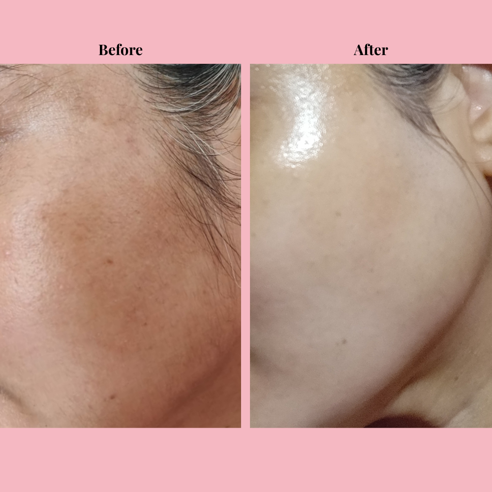 Omera's Cyperus Rotundus Hair Removal Oil